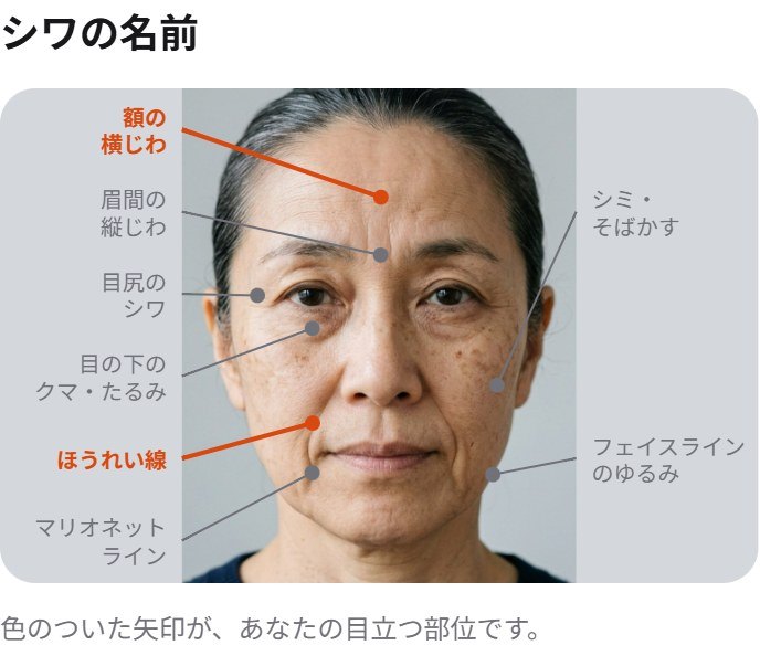 シワの名前を矢印で示した図。目立つ部位だけ色がついている